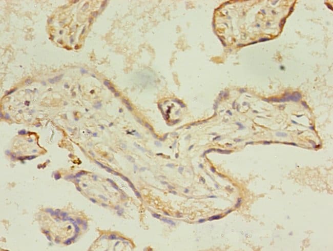 100UG ACSL4 ANTIBODY 100 ug