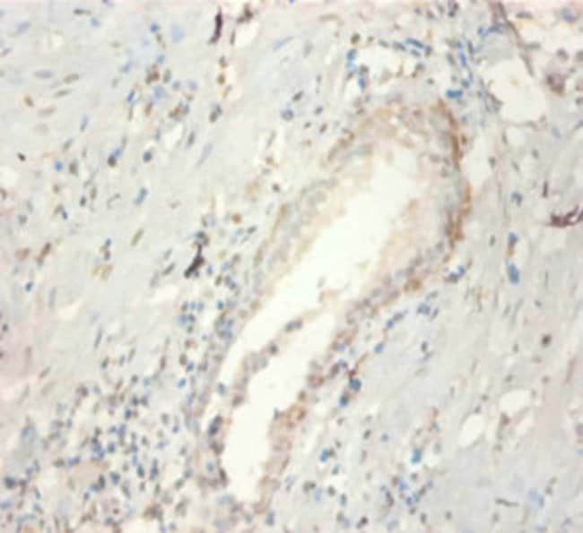 100UG FGF21 ANTIBODY 100 ug