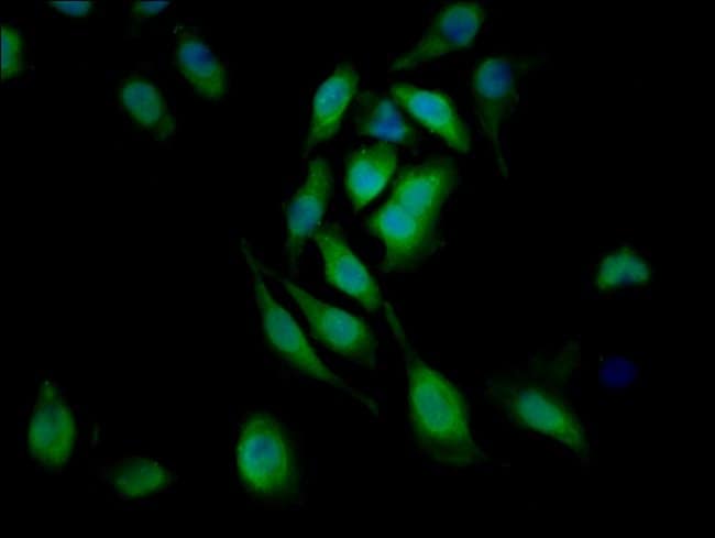 100UG CD171 (L1CAM) ANTIBODY 100 ug