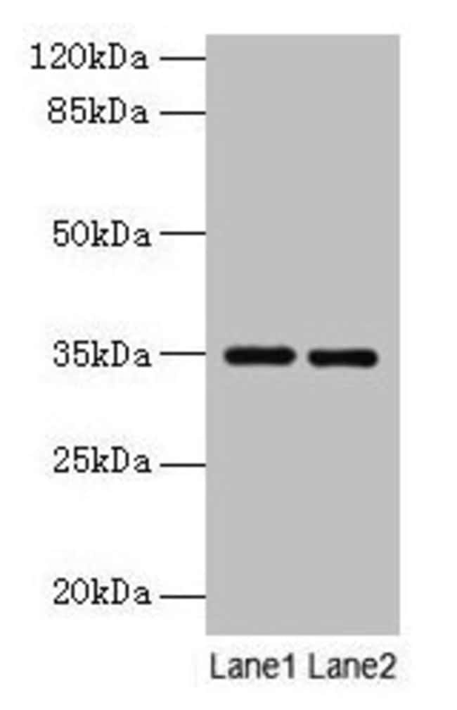 100UG THROMBOPOIETIN ANTIBODY 100 ug