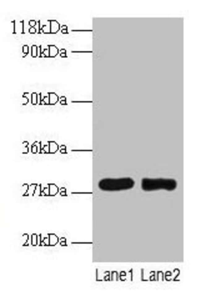 100UG MPZ ANTIBODY 100 ug
