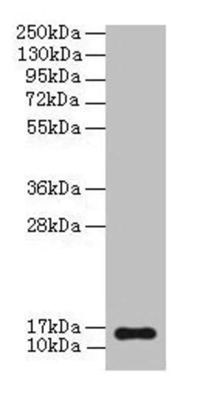 100UG BNP ANTIBODY 100 ug