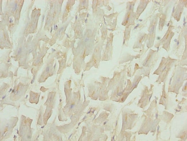 100UG BNP ANTIBODY 100 ug