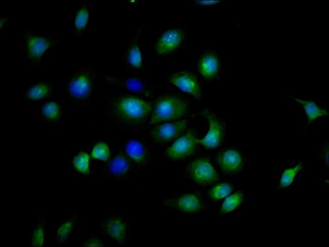 100UG CD137 (4-1BB) ANTIBODY 100 ug