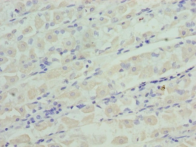 100UG IGFBP1 ANTIBODY 100 ug