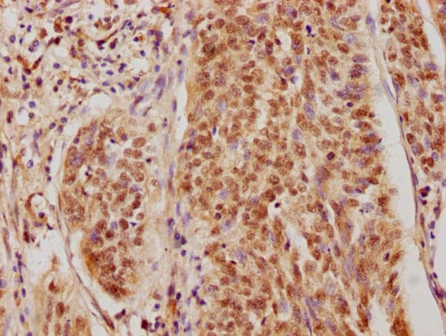 100UL CSNK2A3 ANTIBODY 100 ul