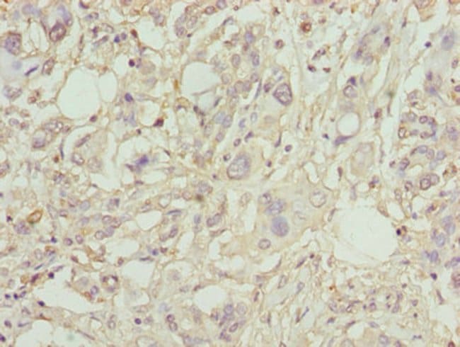 100UG PLA2G7 ANTIBODY 100 ug