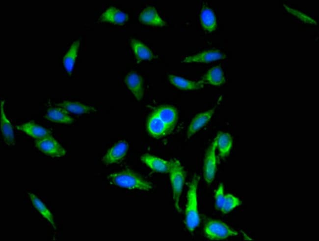 100UG PERIOSTIN ANTIBODY 100 ug