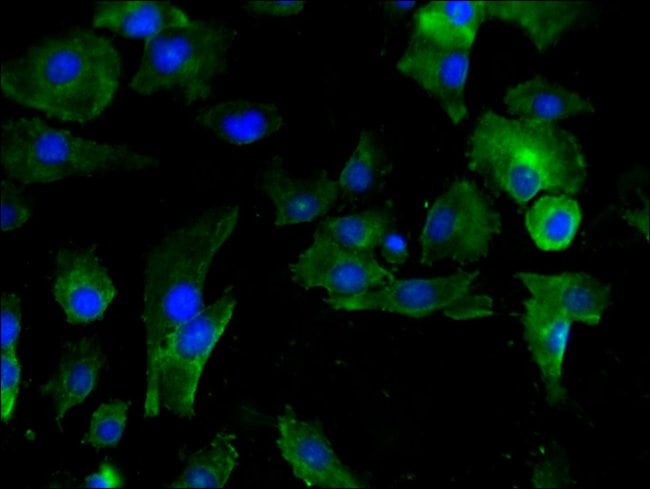 100UG PAI1 ANTIBODY 100 ug