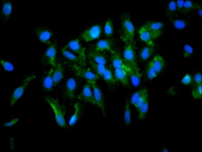 100UG TGM2 ANTIBODY 100 ug