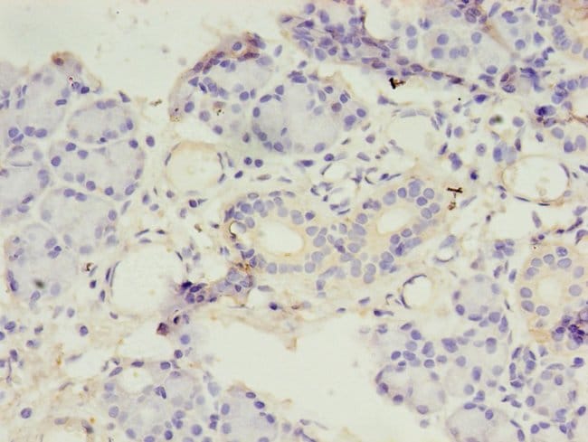 100UG AMYLIN ANTIBODY 100 ug