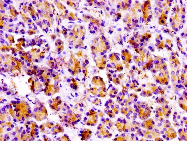 100UG PRSS3 ANTIBODY 100 ug