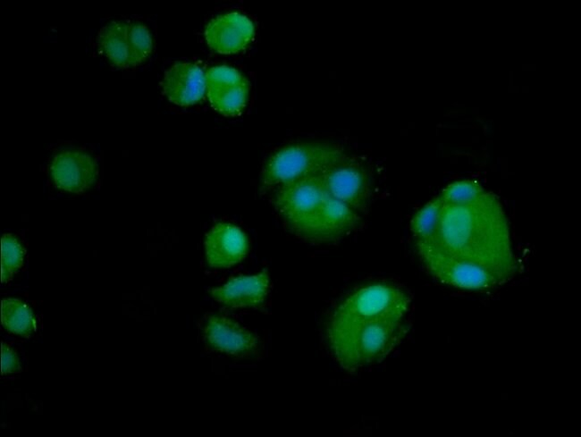100UG AMH ANTIBODY 100 ug