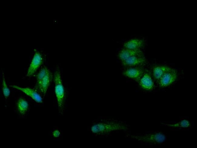 100UG CBS ANTIBODY 100 ug