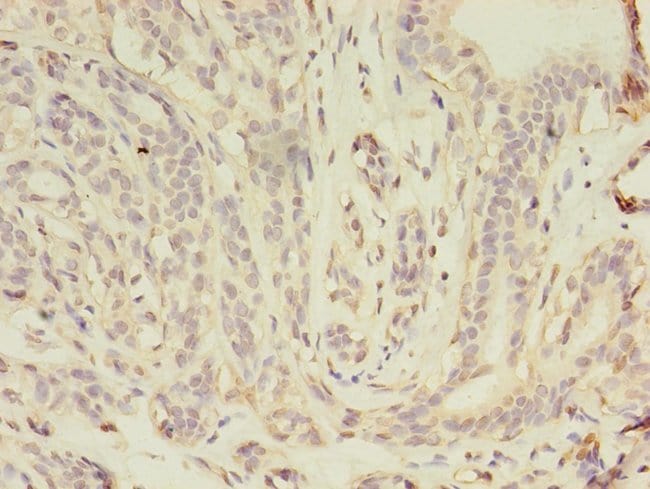 100UG GAMMA CATENIN ANTIBODY 100 ug