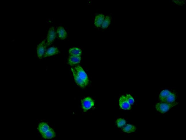 100UG IL17RA ANTIBODY 100 ug