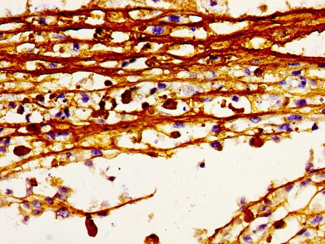 100UG HDC ANTIBODY 100 ug