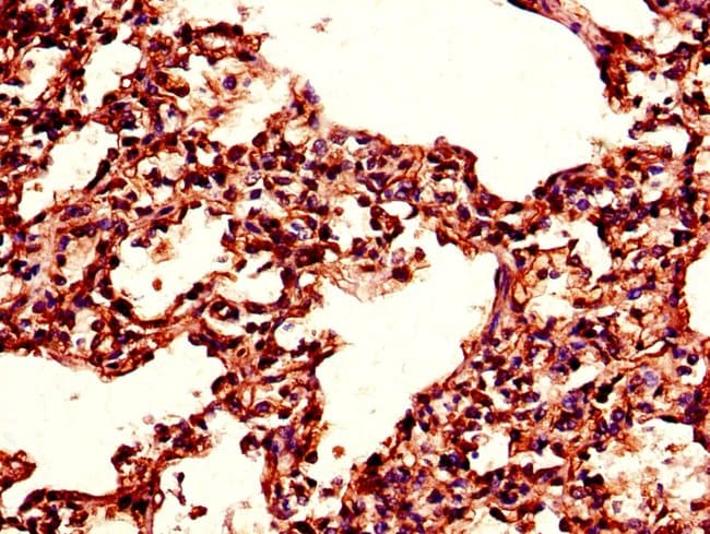100UG TPI1 ANTIBODY 100 ug