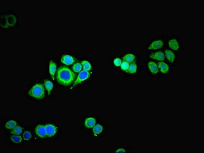 100UG TROVE2 ANTIBODY 100 ug