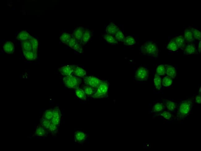 100UG INHBB ANTIBODY 100 ug