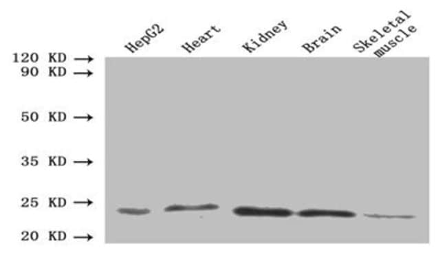 100UG ORM2 ANTIBODY 100 ug