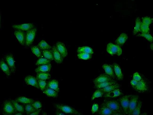 100UG KININOGEN LIGHT CHAIN ANTIBODY 100