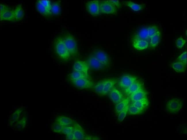 100UG HLA-B ANTIBODY 100 ug