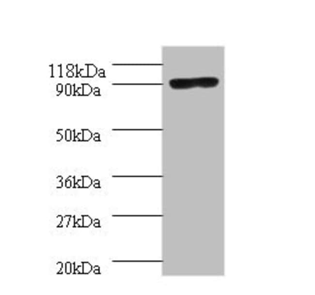 100UG POLA1 ANTIBODY 100 ug