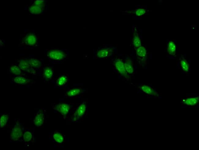 100UG MLH1 ANTIBODY 100 ug