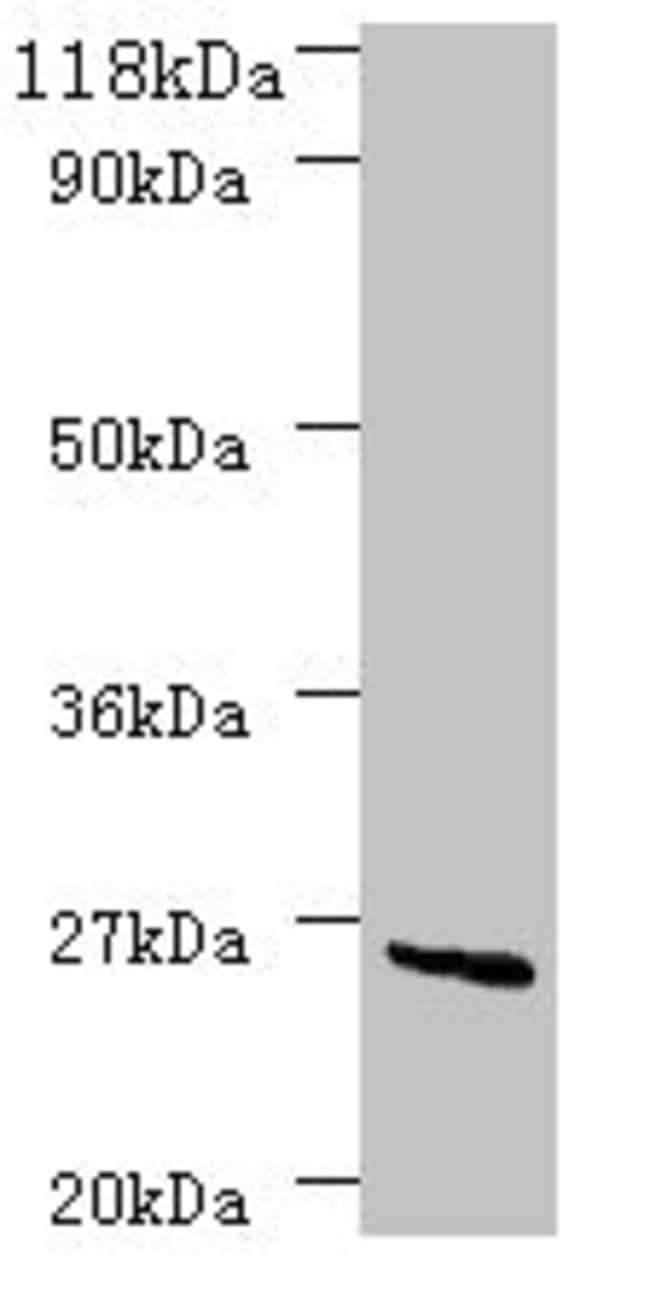 100UG DEOD ANTIBODY 100 ug
