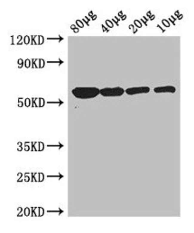 100UG GLYCEROL KINASE ANTIBODY 100 ug