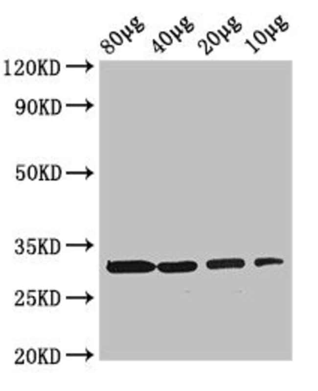 100UG RBKS ANTIBODY 100 ug