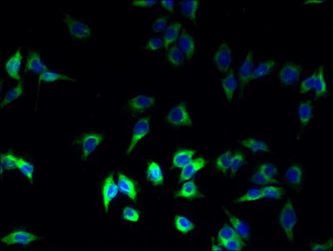 100UG HLA-DRB1 ANTIBODY 100 ug