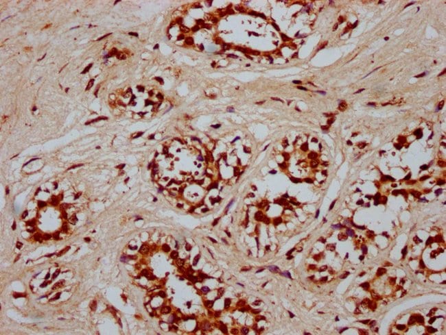 100UG POU5F1B ANTIBODY 100 ug