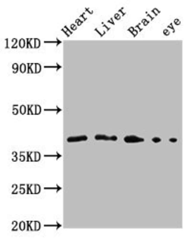 100UL FAS (CD95) ANTIBODY 100 ul