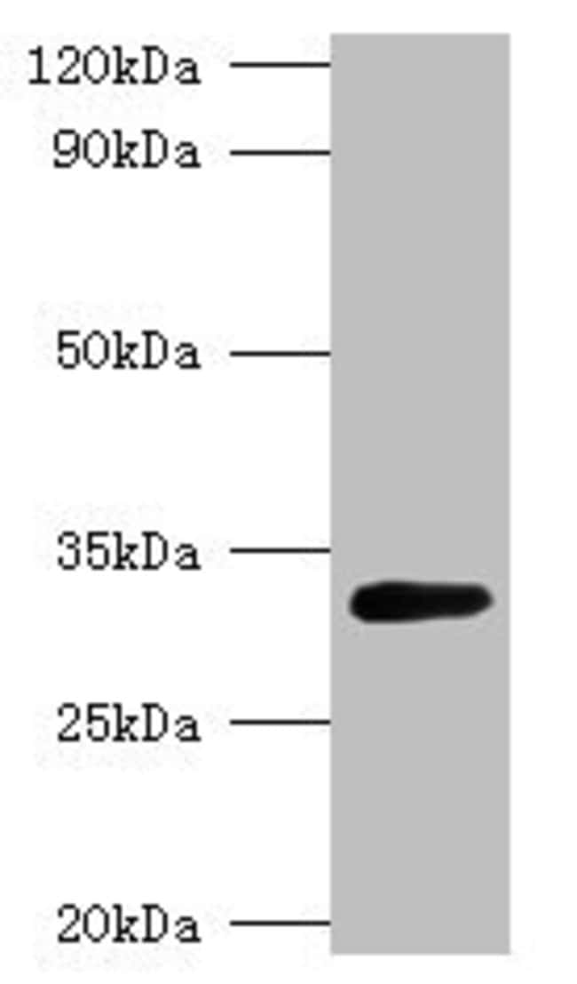 100UG GLSA1 ANTIBODY 100 ug