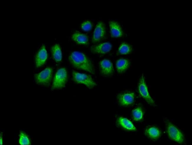 100UG HLA-DRB3 ANTIBODY 100 ug