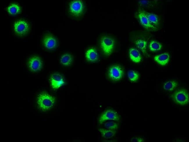100UG HLA-ABC ANTIBODY 100 ug
