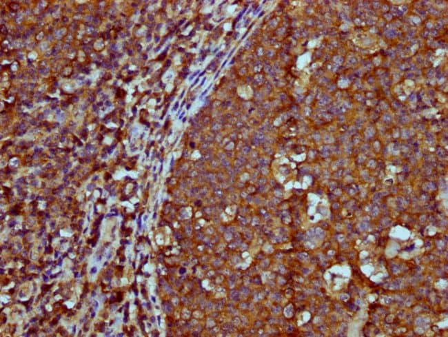 100UG IGHM ANTIBODY 100 ug