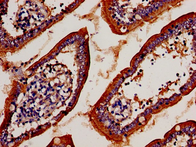 100UG TCR V BETA 7.9 ANTIBODY 100 ug