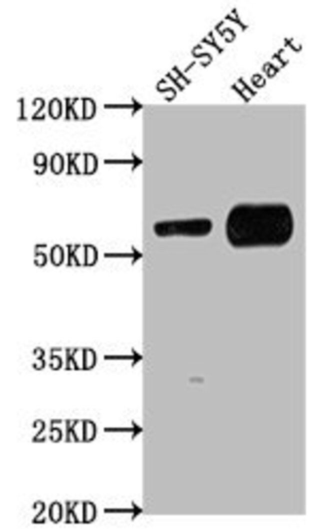 100UL JRK ANTIBODY 100 ul
