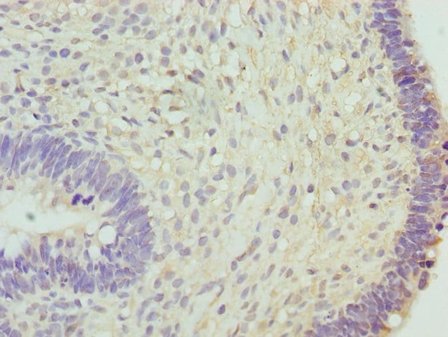 100UL HCE ANTIBODY 100 ul
