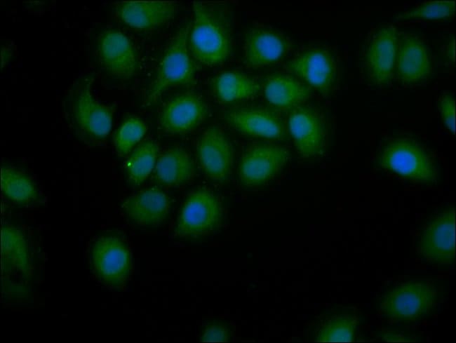 100UG PDE9A ANTIBODY 100 ug