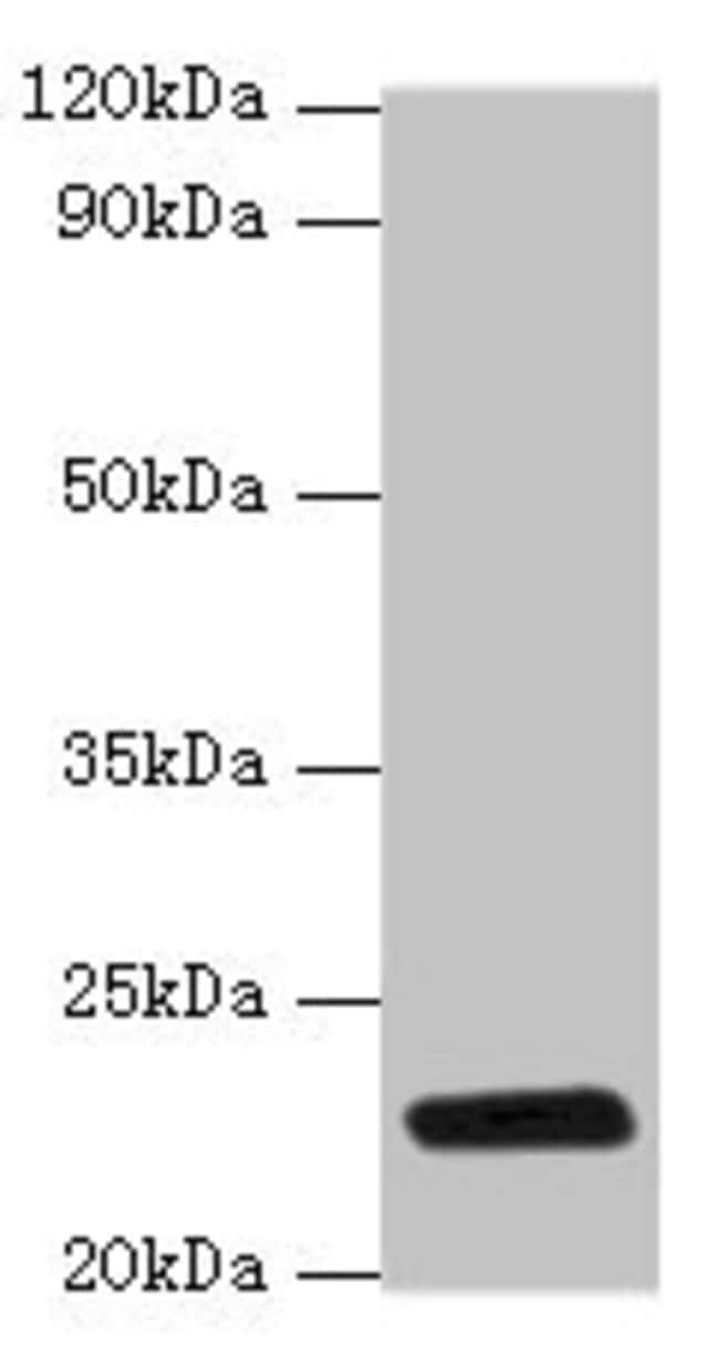 100UG RPIA ANTIBODY 100 ug
