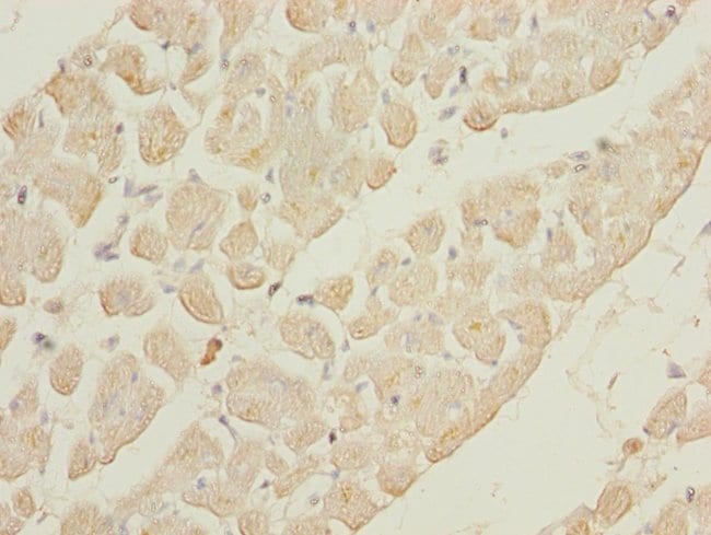 100UL GALNT2 ANTIBODY 100 ul
