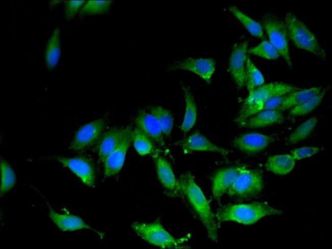 100UG OS9 ANTIBODY 100 ug