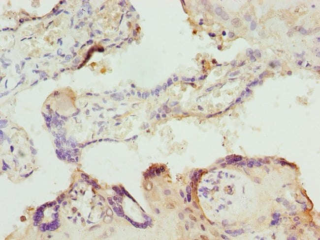 100UL ITPK1 ANTIBODY 100 ul