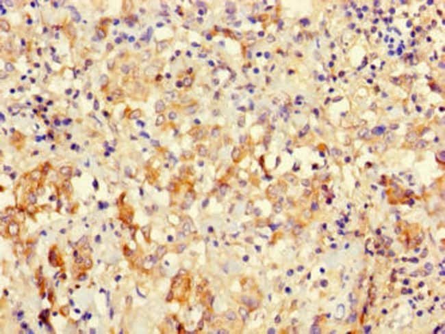 100UG ICT1 ANTIBODY 100 ug