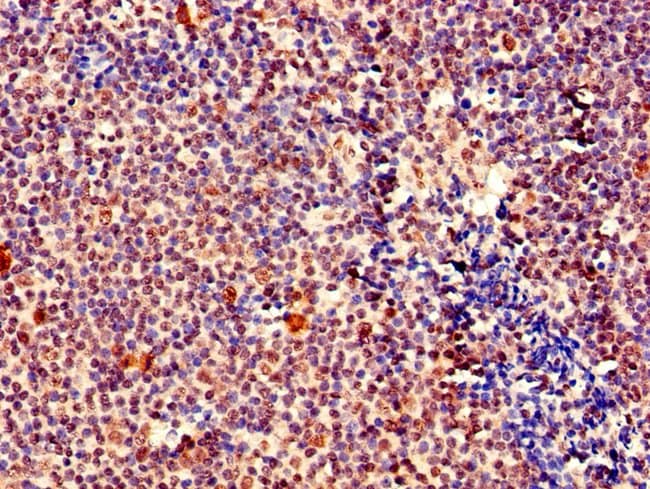 100UG MEF2D ANTIBODY 100 ug