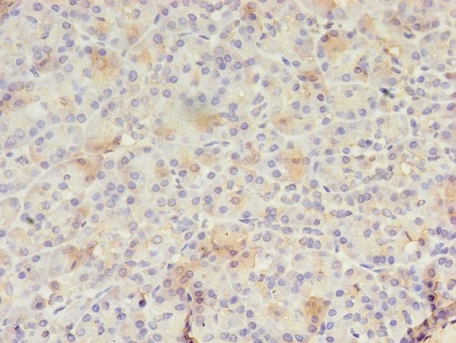 100UG RAB30 ANTIBODY 100 ug